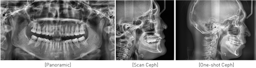 Panoramic, Scan Ceph, One-shot Ceph X-ray 이미지