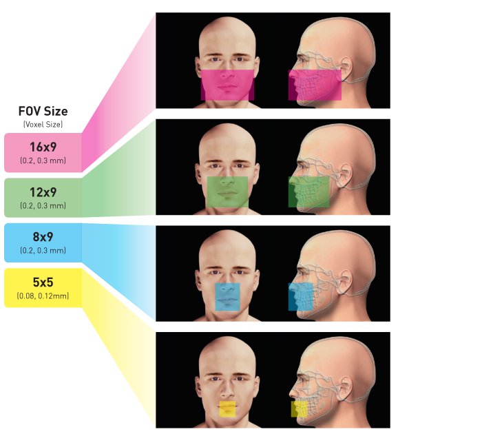 FOV Size 16*9, 12*9, 8*9, 5*5